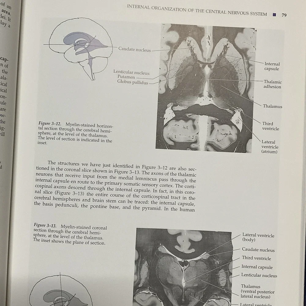 Neuroanatomy Atlas John H. Martin Text‎ And Atlas Second Edition